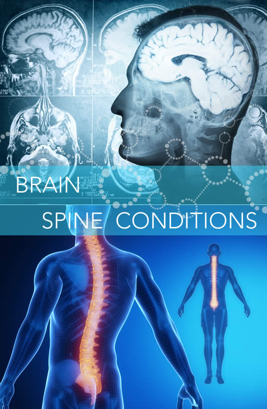 Spine and Brain Conditions We Treat